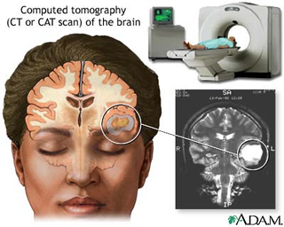 Illustration for article titled Six Ways Science Can See Into Your Brain